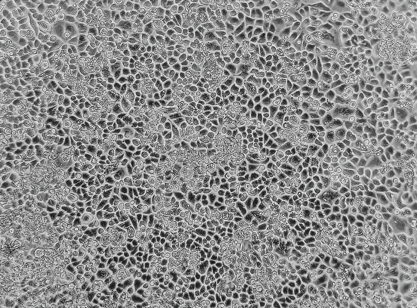 کشت سلول های ثانویه سرطان معده در آزمایشگاه آناهیتا (مدل دو بعدی)