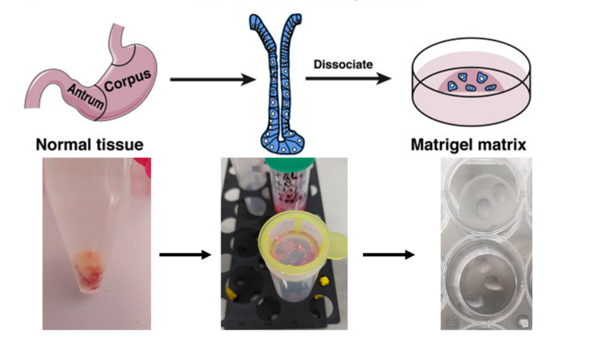 مدل سازی ارگانوئیدی از بافت منشا گرفته بیمار مبتلا به سرطان معده در آزمایشگاه آناهیتا